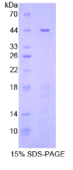 信号传导转录激活因子3(STAT3)重组蛋白