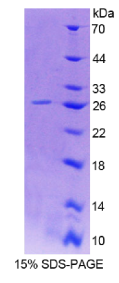 去唾液酸糖蛋白受体1(ASGPR1)重组蛋白