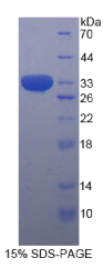 信号传导转录激活因子1(STAT1)重组蛋白