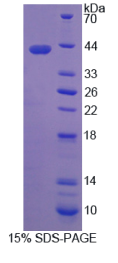 视黄醛结合蛋白1(RLBP1)重组蛋白