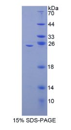 核因子κB2(NFκB2)重组蛋白