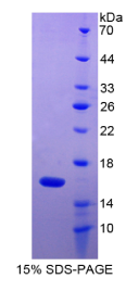 巨噬细胞炎性蛋白1γ(MIP1γ)重组蛋白