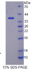 妊娠特异性β1-糖蛋白2(PSG2)重组蛋白