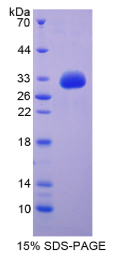 生长分化因子11(GDF11)重组蛋白