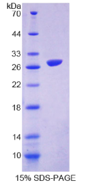 信号调节蛋白β1(SIRPβ1)重组蛋白