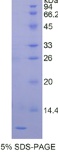 胎盘特异性蛋白9(PLAC9)重组蛋白