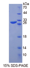 软骨糖蛋白39(GP39)重组蛋白