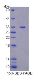 羧基端结合蛋白2(CTBP2)重组蛋白