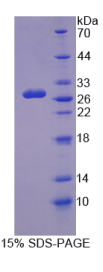 鸟苷酸环化酶1β3(GUCY1β3)重组蛋白