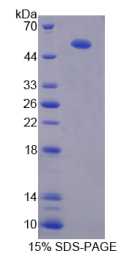 腱蛋白样蛋白1(CHRDL1)重组蛋白