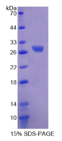钠/钾离子转运ATP酶β3肽(ATP1β3)重组蛋白