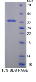 类胰蛋白酶β2(TPSβ2)重组蛋白