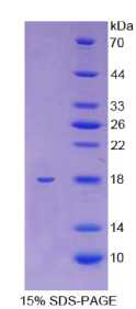 驱动蛋白家族成员5A(KIF5A)重组蛋白