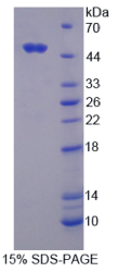 环指蛋白39(RNF39)重组蛋白