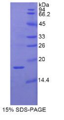视黄醇结合蛋白2(RBP2)重组蛋白