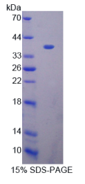 乳腺癌扩增序列3(BCAS3)重组蛋白