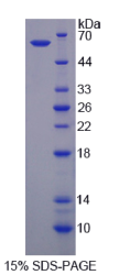 乳腺癌抗雌激素药物耐药性基因3(BCAR3)重组蛋白