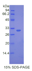 钠/钾离子转运ATP酶β1肽(ATP1β1)重组蛋白