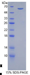 肾上腺素能受体β激酶1(ADRβK1)重组蛋白
