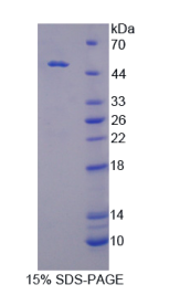 酪蛋白激酶1δ(CSNK1δ)重组蛋白