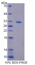 乳腺癌易感蛋白2(BRCA2)重组蛋白