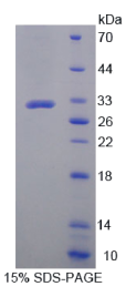 锌指蛋白10(ZNF10)重组蛋白