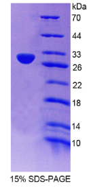 乳腺癌易感蛋白2(BRCA2)重组蛋白