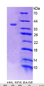 互生蛋白β1(SNTβ1)重组蛋白