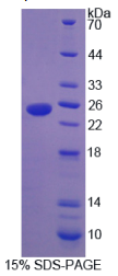 热休克蛋白β7(HSPβ7)重组蛋白