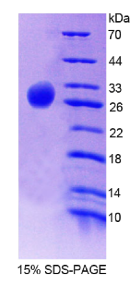 前列腺素E合酶2(PTGES2)重组蛋白