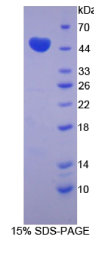 嗜铬蛋白B(CHGB)重组蛋白