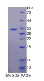 前蛋白转化酶枯草溶菌素9(PCSK9)重组蛋白