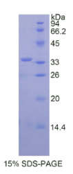 丝氨酸肽酶抑制因子Kazal型5(SPINK5)重组蛋白