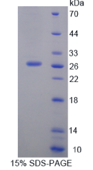 信号淋巴细胞激活分子家族成员1(SLAMF1)重组蛋白