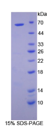 糖原合酶激酶3α(GSK3α)重组蛋白