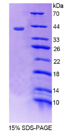 肾损伤分子1(Kim1)重组蛋白