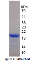 杀伤细胞凝集素样受体亚家族D成员1(KLRD1)重组蛋白