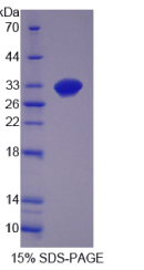 生长分化因子11(GDF11)重组蛋白