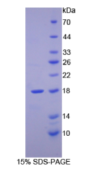 视黄醇结合蛋白2(RBP2)重组蛋白