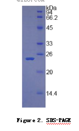 视黄醇结合蛋白4(RBP4)重组蛋白