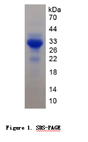 信号调节蛋白β1(SIRPβ1)重组蛋白