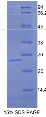 肉毒碱棕榈酰基转移酶1A(CPT1A)重组蛋白