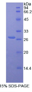 连环蛋白β1(CTNNβ1)重组蛋白