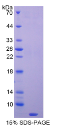 胸腺素β4(Tβ4)重组蛋白