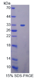 信号传导转录激活因子2(STAT2)重组蛋白