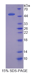 溶质载体家族1成员5(SLC1A5)重组蛋白
