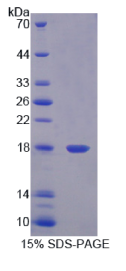 食道癌相关基因4(ECRG4)重组蛋白