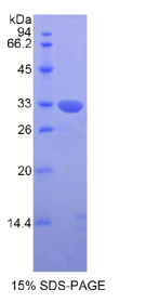 杀伤细胞免疫球蛋白样受体2DS4(KIR2DS4)重组蛋白