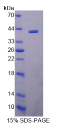 无翅型MMTV整合位点家族成员5B(WNT5B)重组蛋白