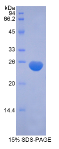 肌球蛋白轻链12B(MYL12B)重组蛋白
